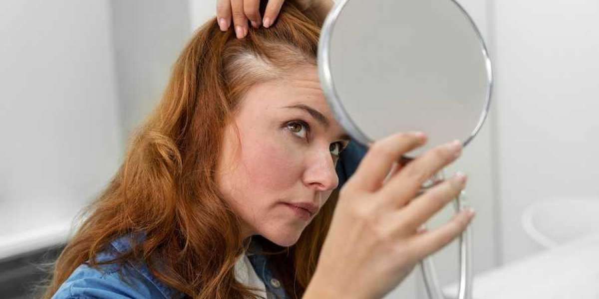 Frontal fibrosing alopecia: alopecia that affects women