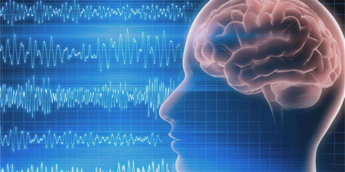 Neurodiagnostics Market Players To See Prolific Expansion In The Upcoming Forecast Period